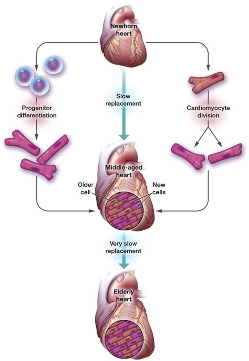 heart disease stem cell therapy, heart stem cells, stem cells for heart, cardiovascular disease treatment, heart stem cell treatment, 